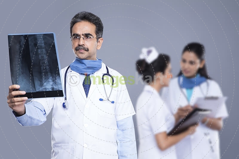 Doctors with x ray reports behind medical staff